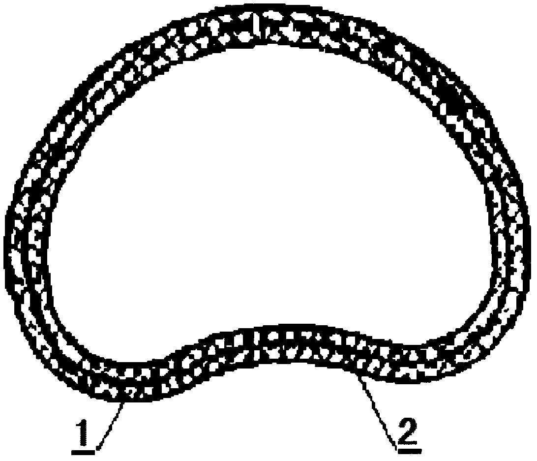 Mesh type mitral valvuloplasty ring