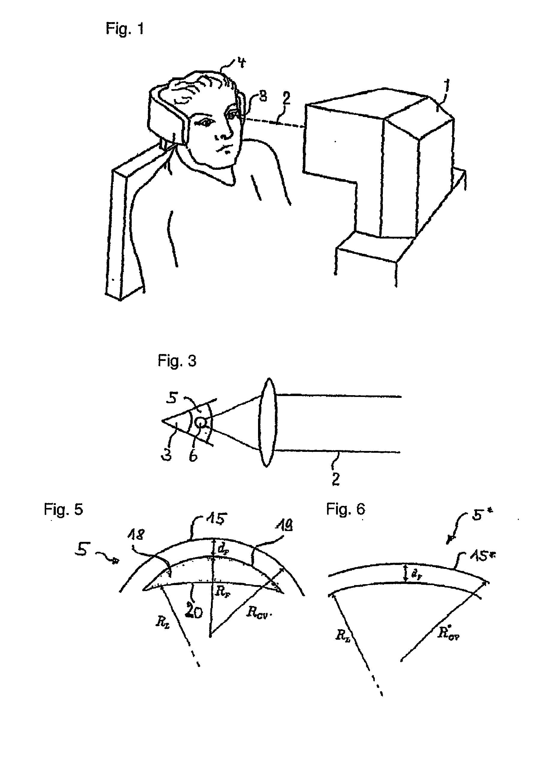 Treatment device for the surgical correction of defective vision of an eye, method for producing control data therefor, and method for the surgical correction of defective vision of an eye