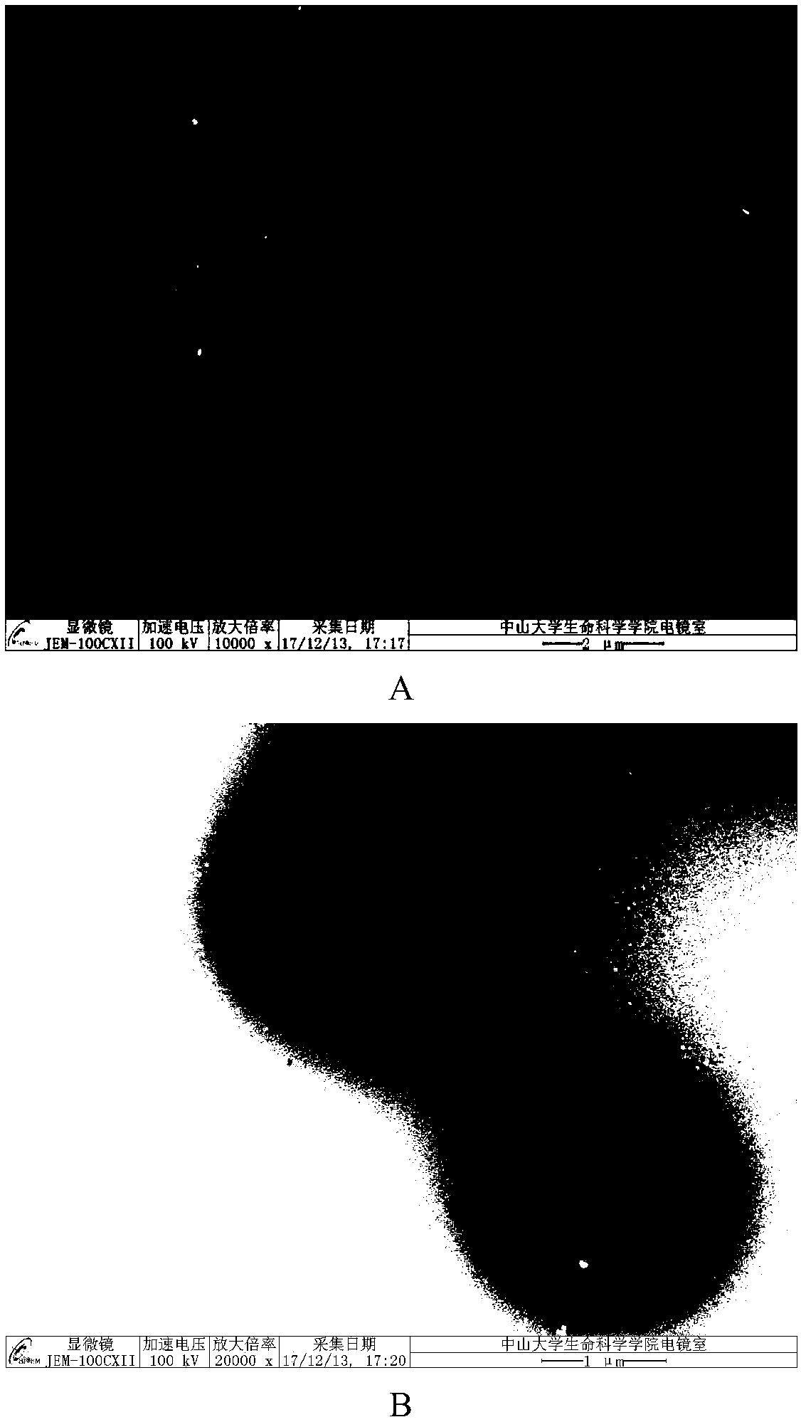 Composite micro-sphere co-carrying adriamycin nanoparticles and ginsenoside rh2 and preparation method thereof