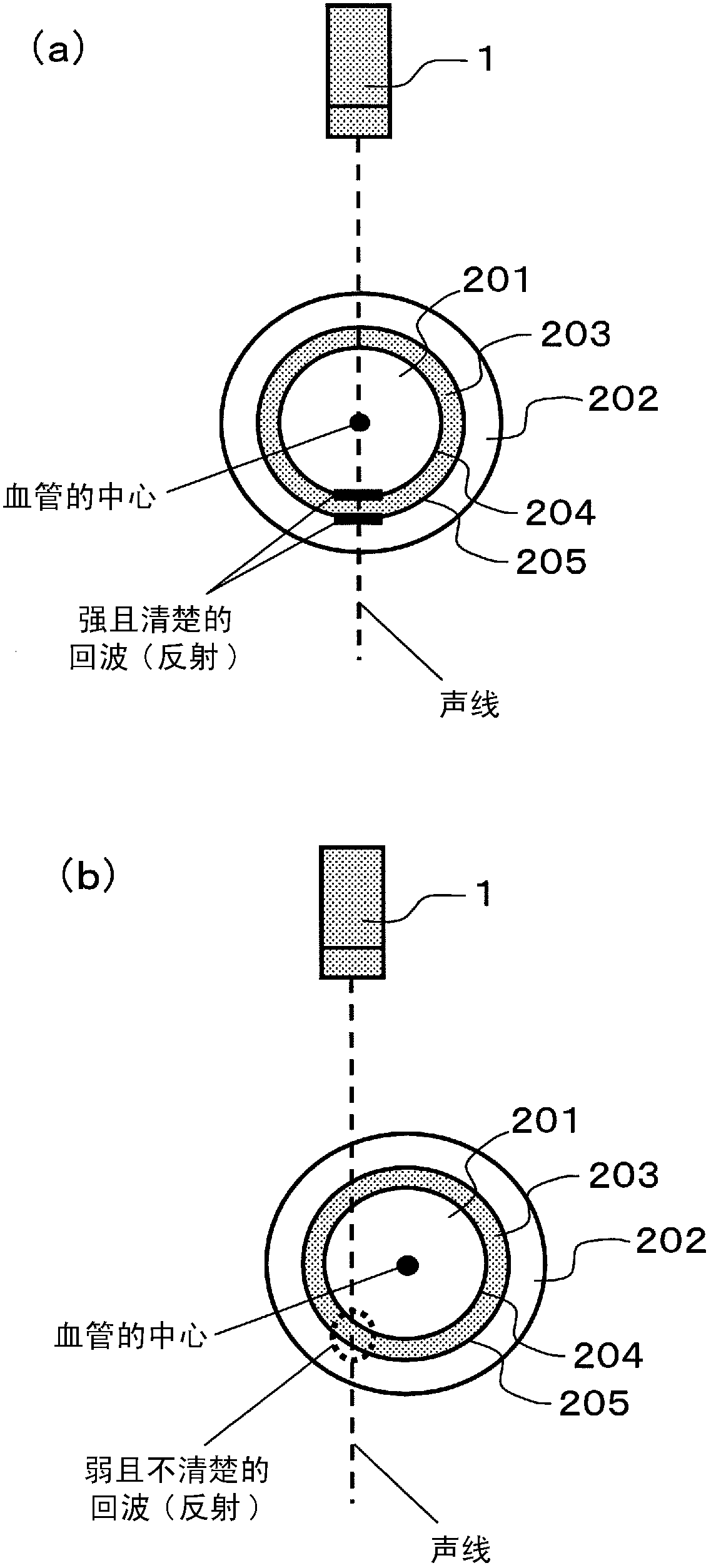 Ultrasound diagnostic apparatus and ultrasound diagnostic apparatus control method