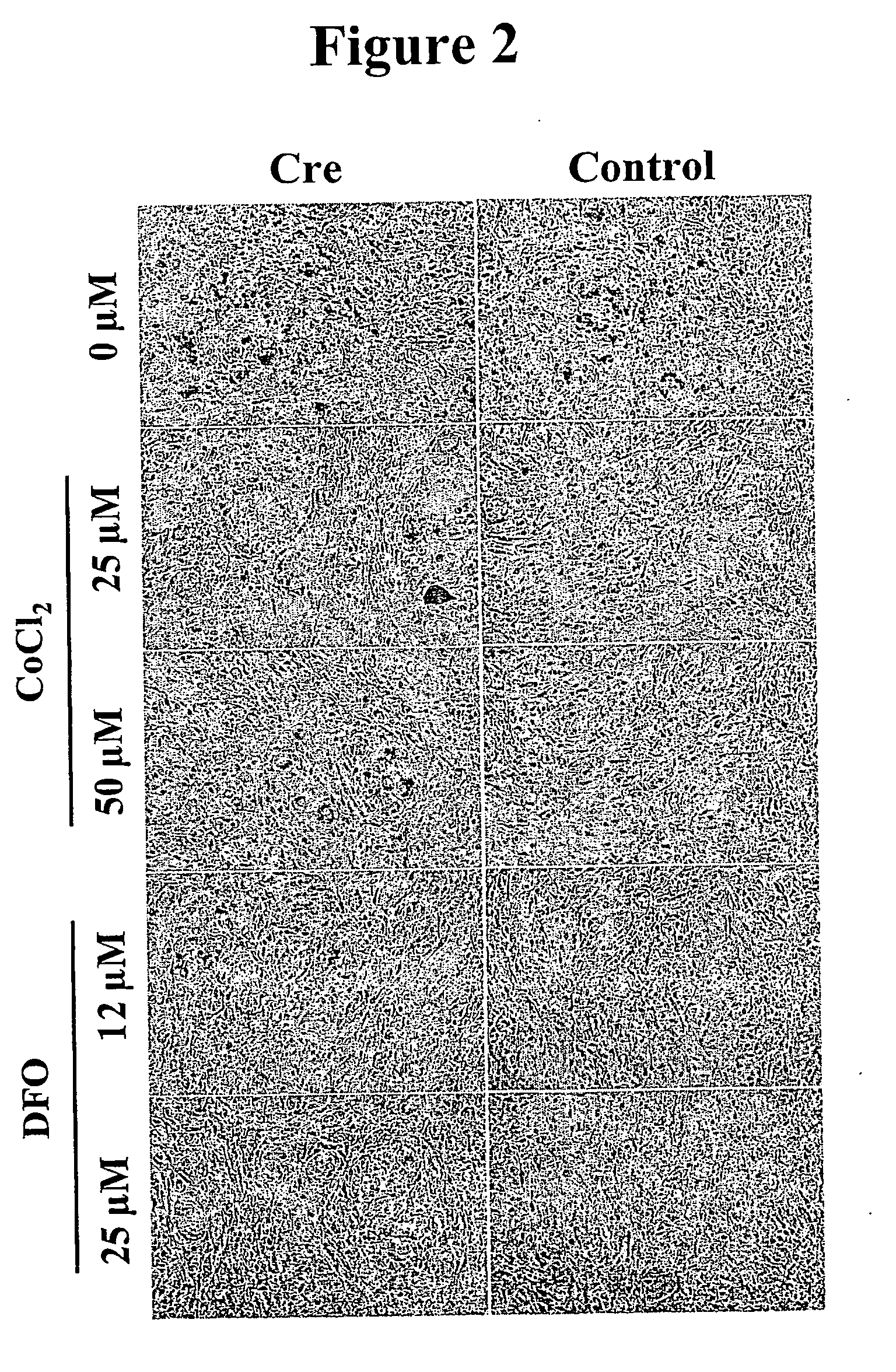 Methods and compositions for regulating adipogenesis