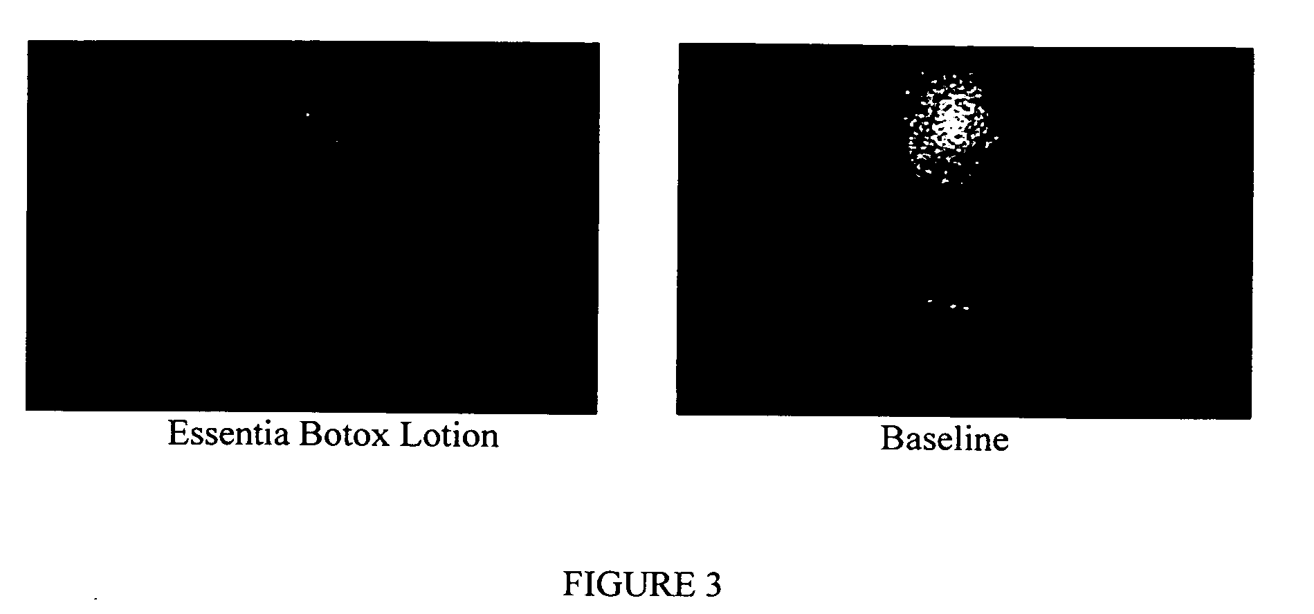 Compositions and methods for topical application and transdermal delivery of botulinum toxins