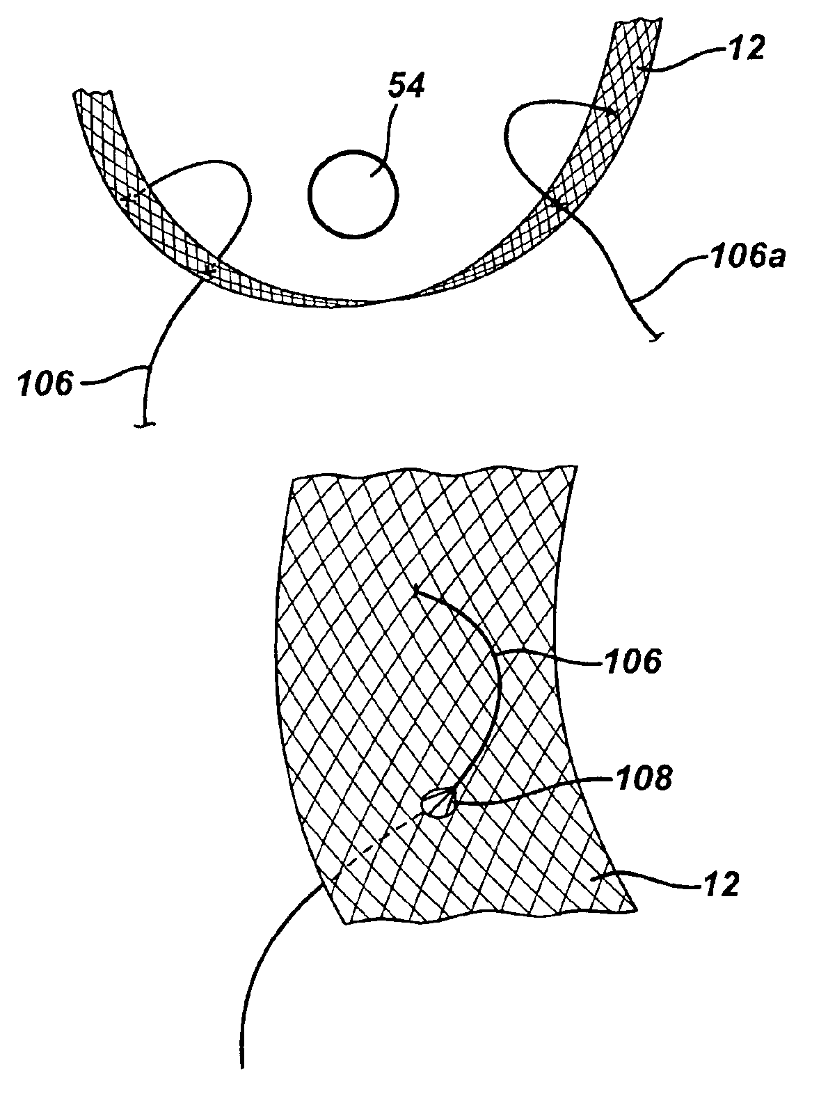 Method and apparatus for adjusting flexible areal polymer implants