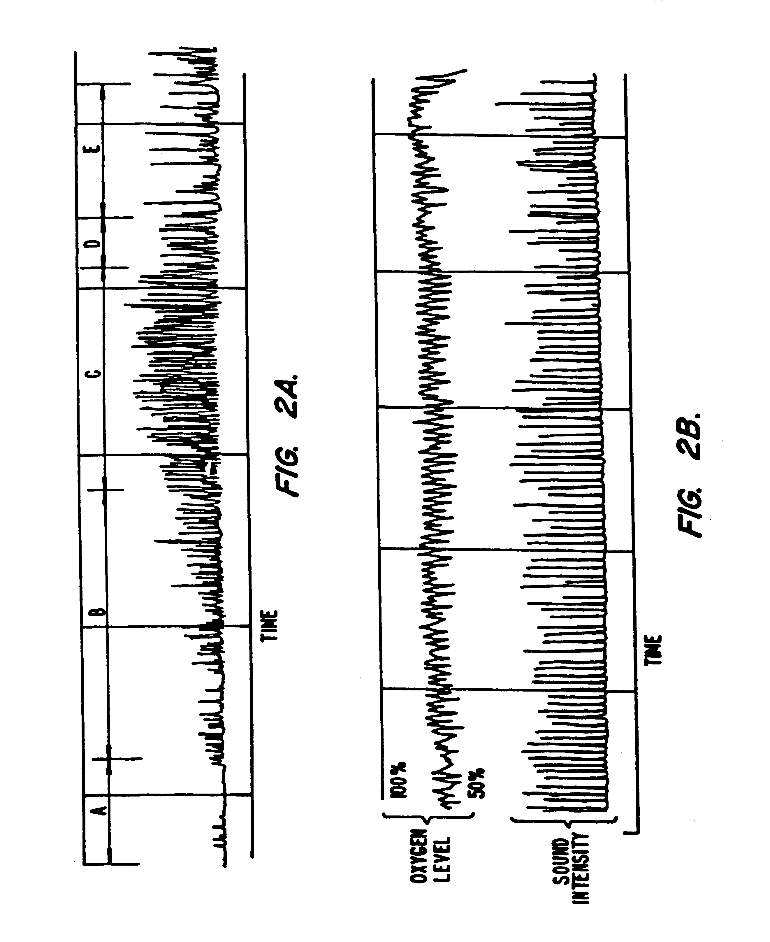 Device and method for nonclinical monitoring of breathing during sleep, control of CPAP treatment and preventing apnea
