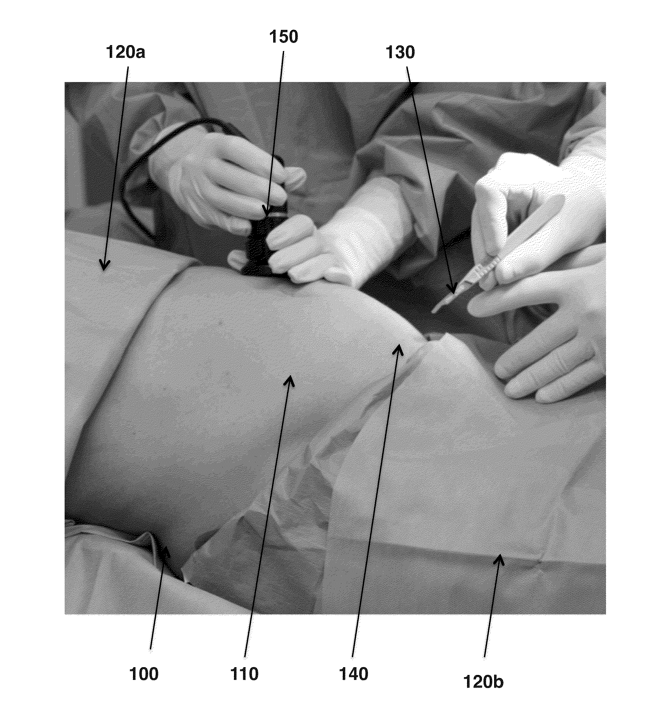 Method for Obtaining Sterile Human Amniotic Fluid and Uses Thereof