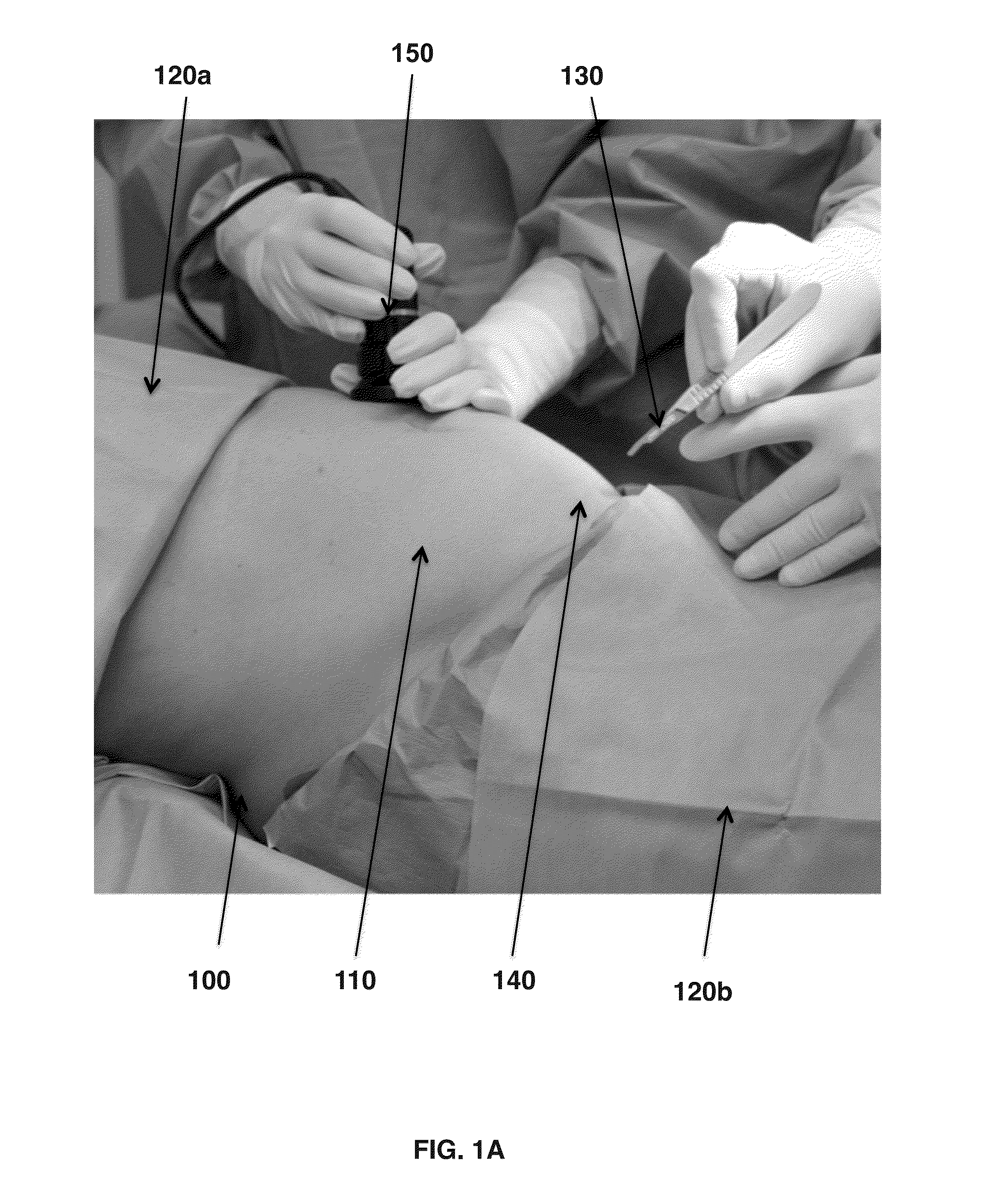 Method for Obtaining Sterile Human Amniotic Fluid and Uses Thereof