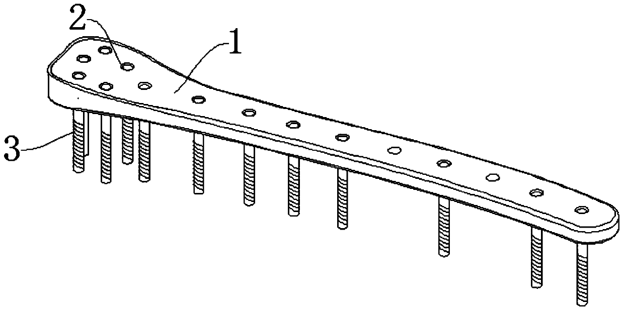 Tibia locking nail plate external fixator and using method thereof