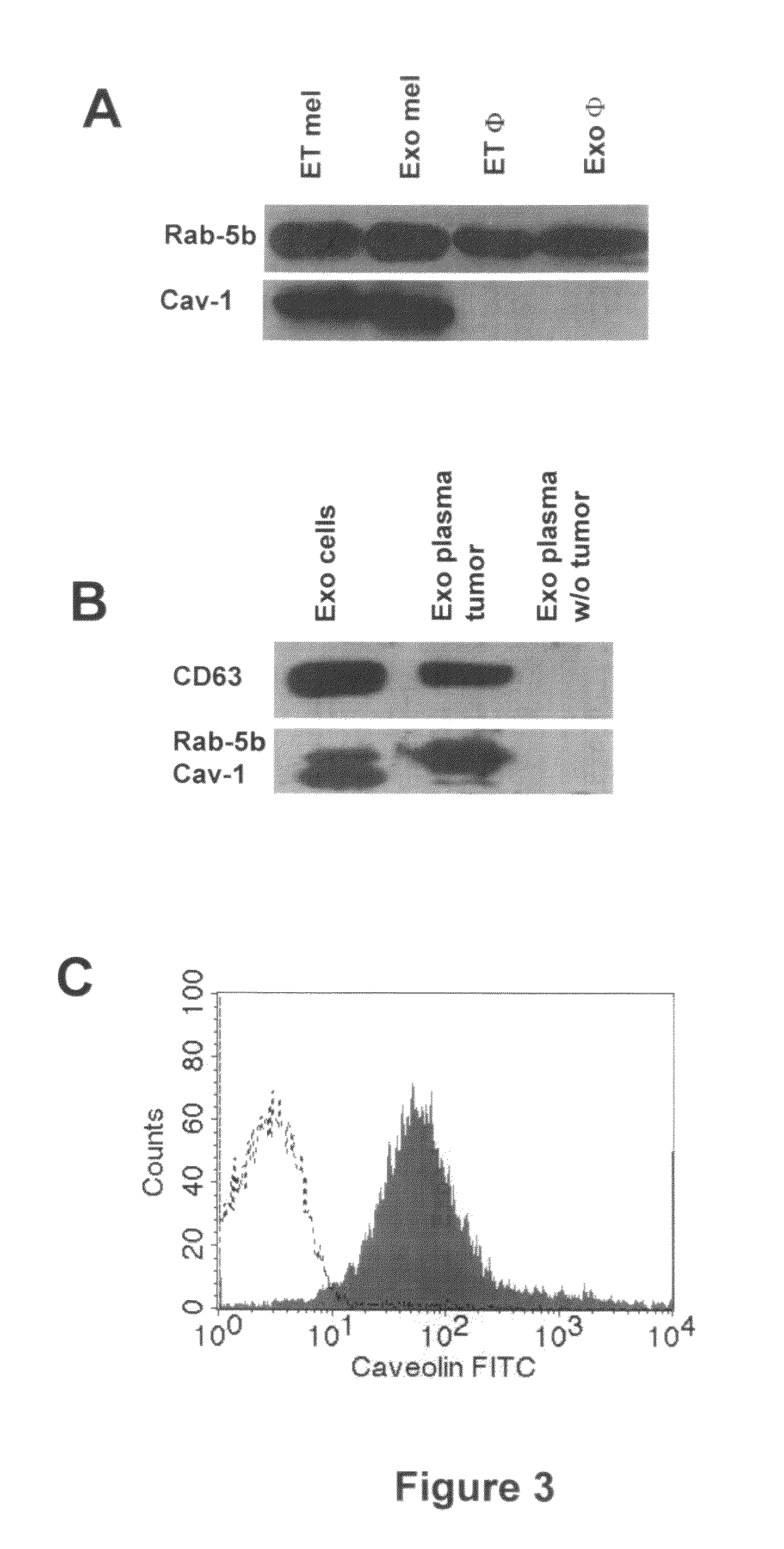 Method to measure and characterize microvesicles in the human body fluids