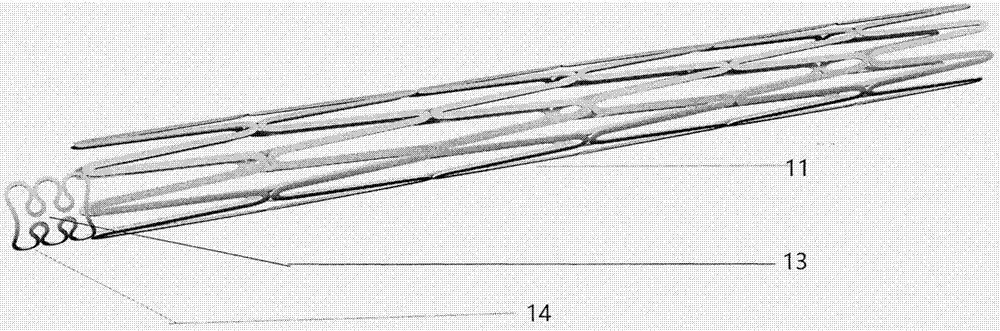Coronary artery branch support with locating ring