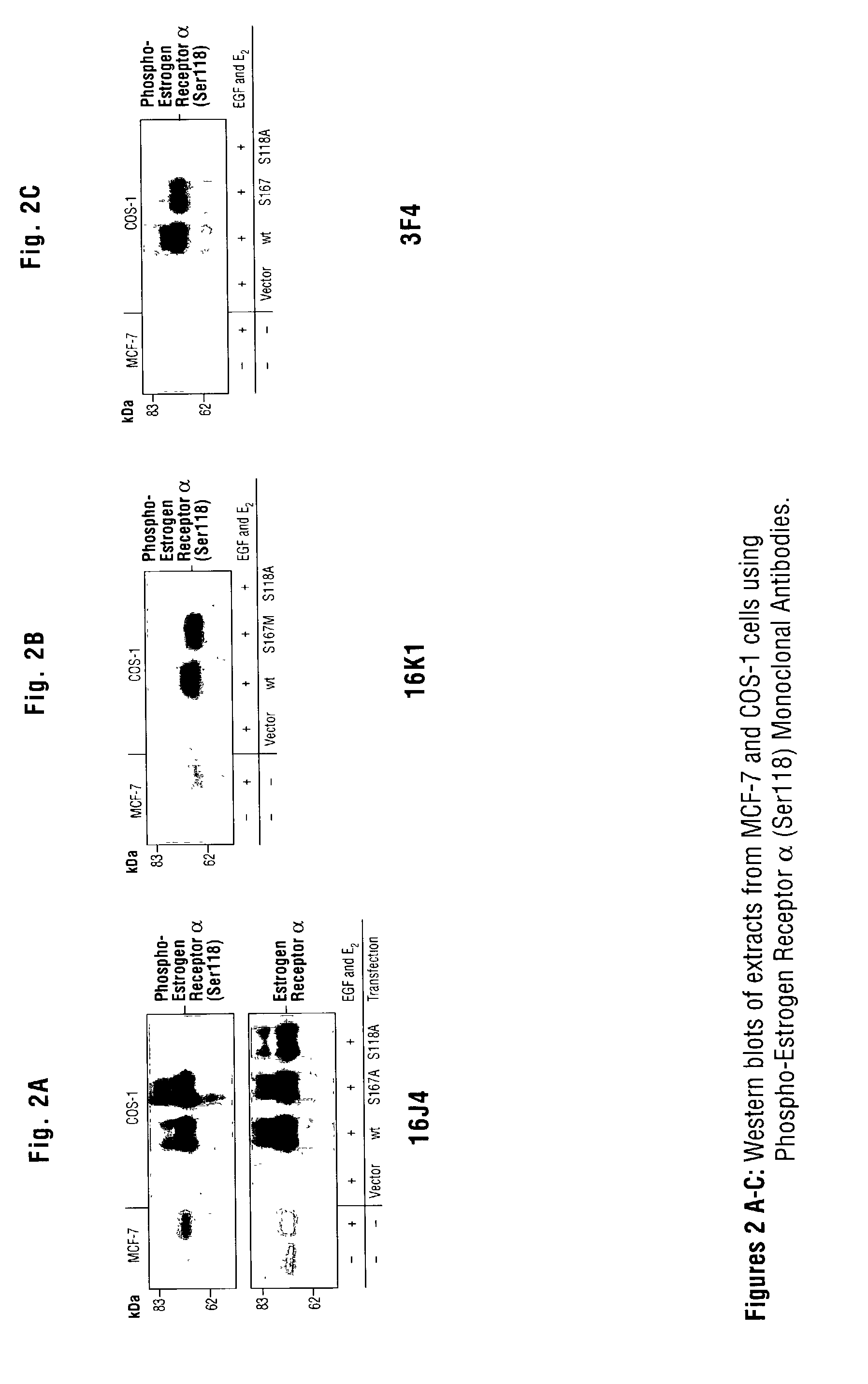 Monoclonal antibodies specific for phosphorylated estrogen receptor alpha (Ser118) and uses thereof