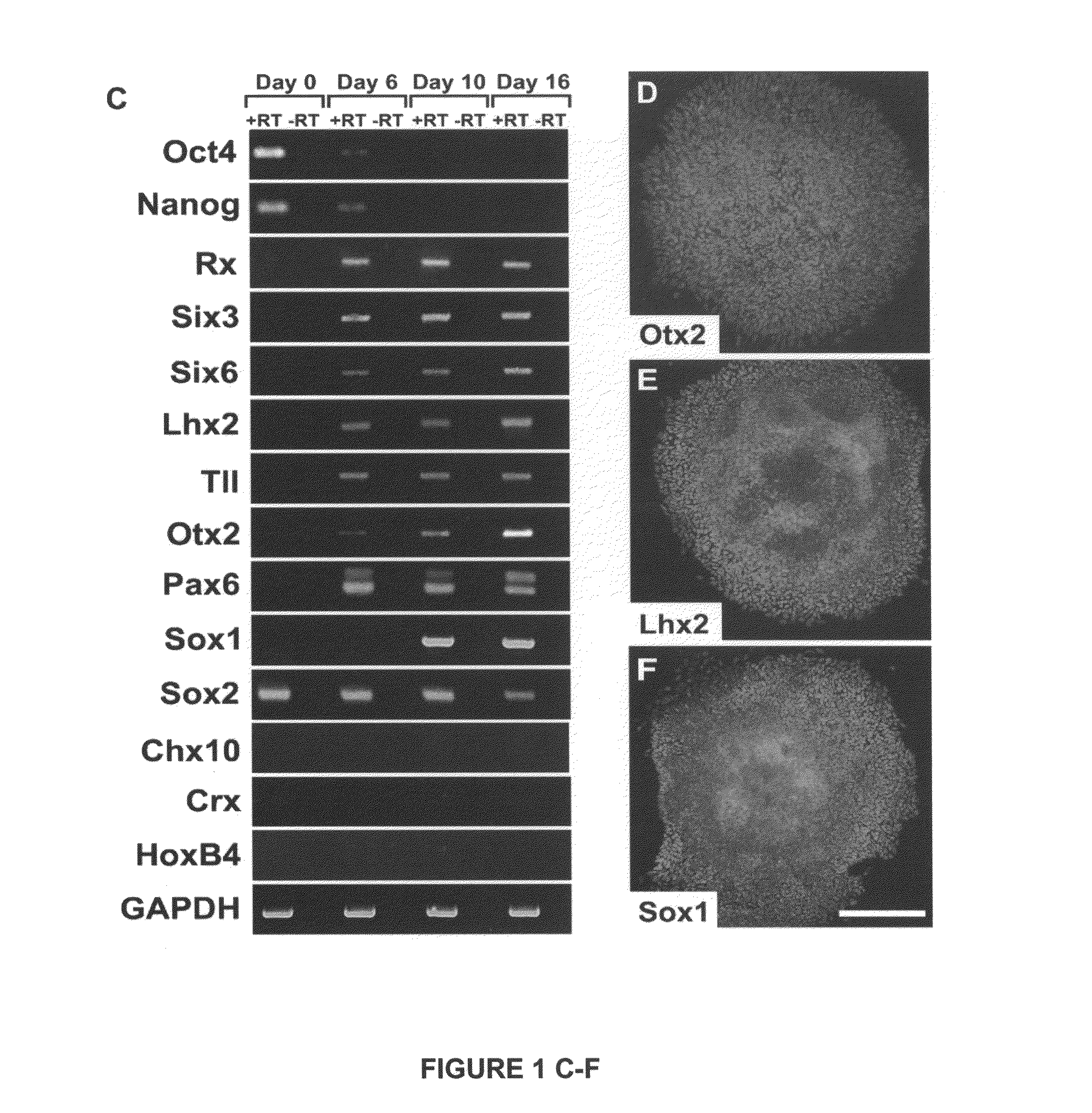 Substantially pure human retinal progenitor, forebrain progenitor, and retinal pigment epithelium cell cultures and methods of making the same