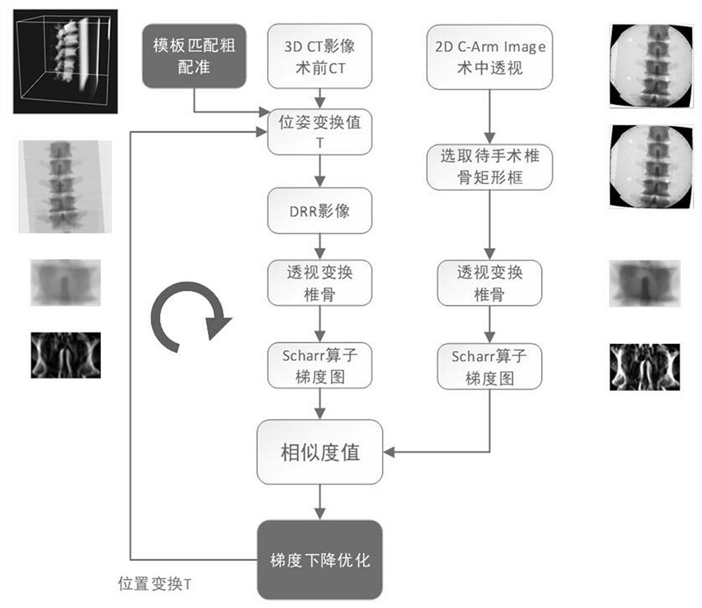 A 2d-3d Image Registration Algorithm