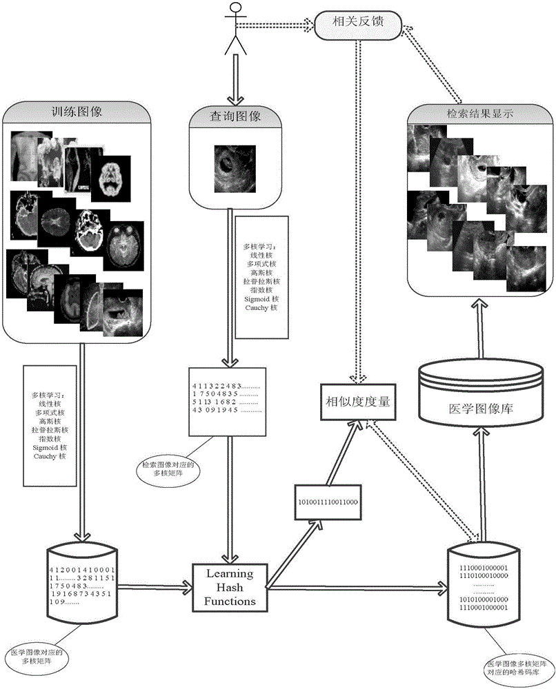 Multi-kernel hash learning-based large-scale medical image retrieval method