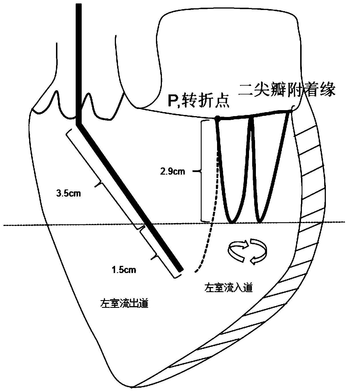 Percutaneous left heart drainage tube
