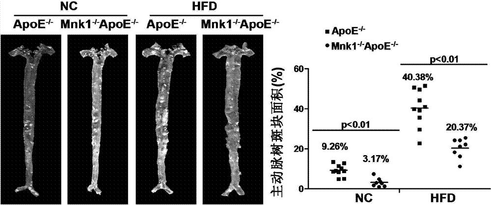Function and application of MAPK (mitogen-activated protein kinase) signal-integrating kinase 1 in treatment of atherosclerosis