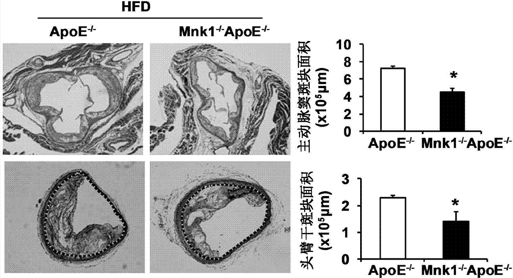 Function and application of MAPK (mitogen-activated protein kinase) signal-integrating kinase 1 in treatment of atherosclerosis