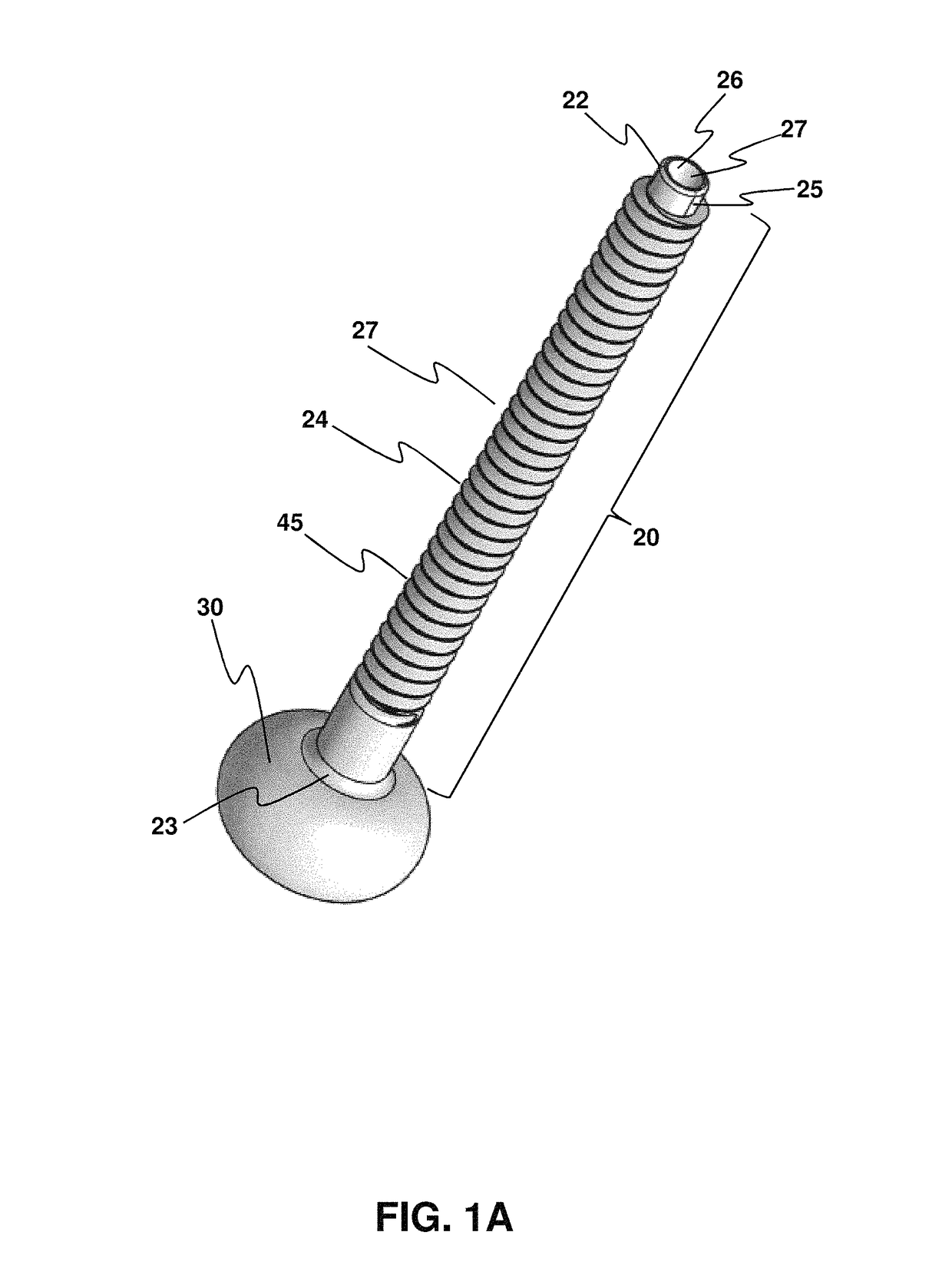 Transabdominal gastric device and method