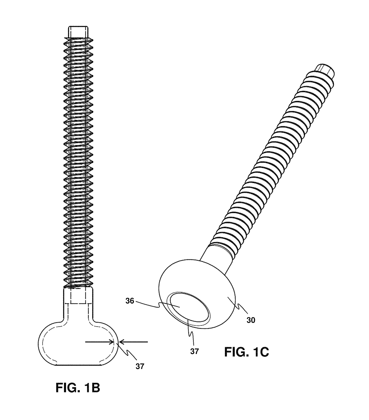 Transabdominal gastric device and method