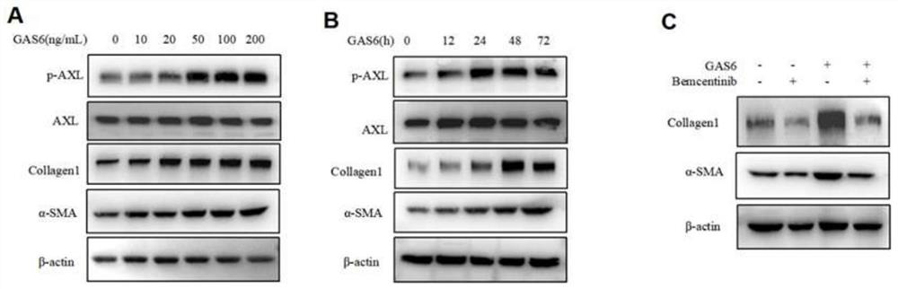 Application of AXL as diagnosis and treatment target of intrauterine adhesion