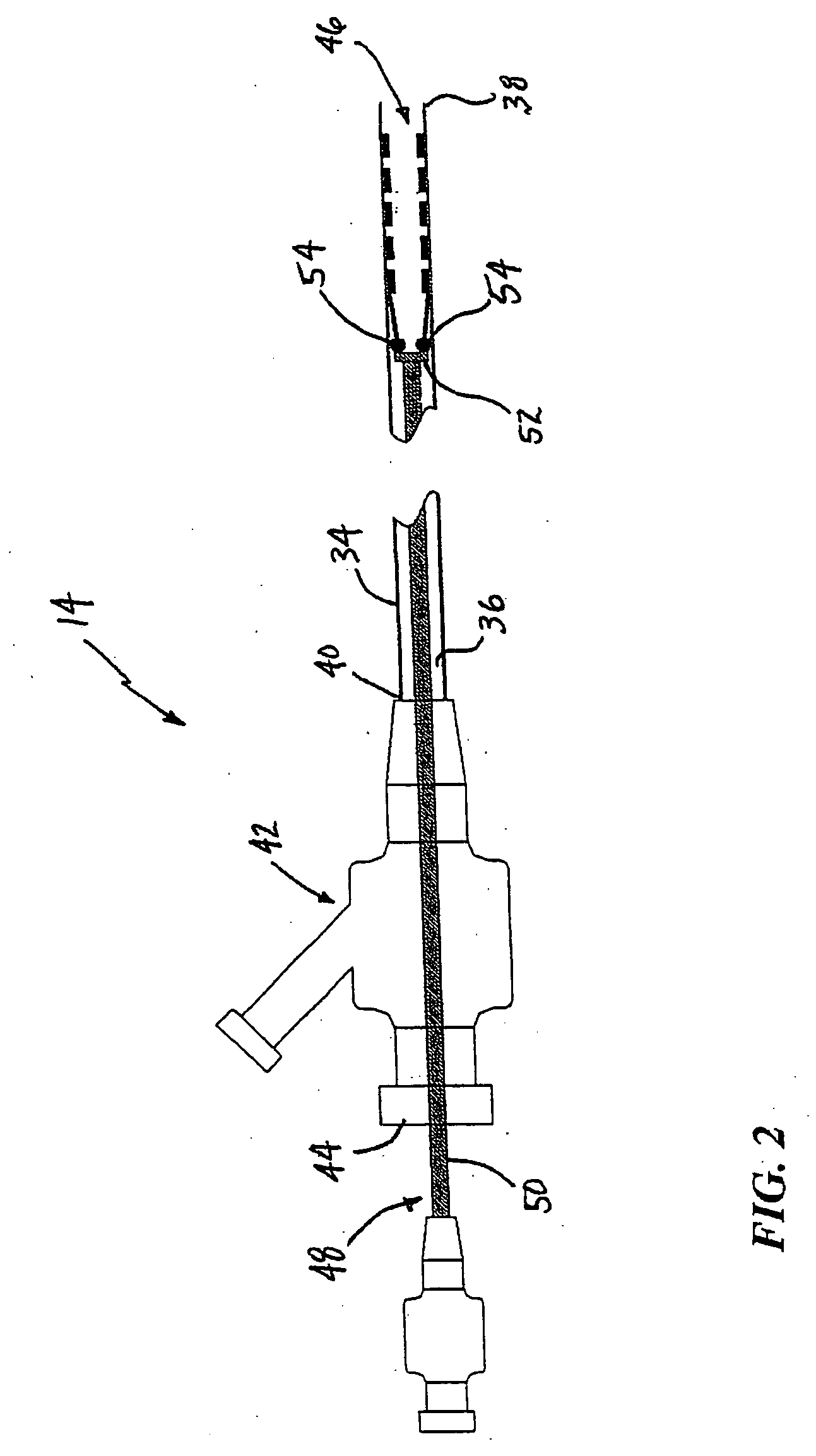 System and method for treating ischemic stroke