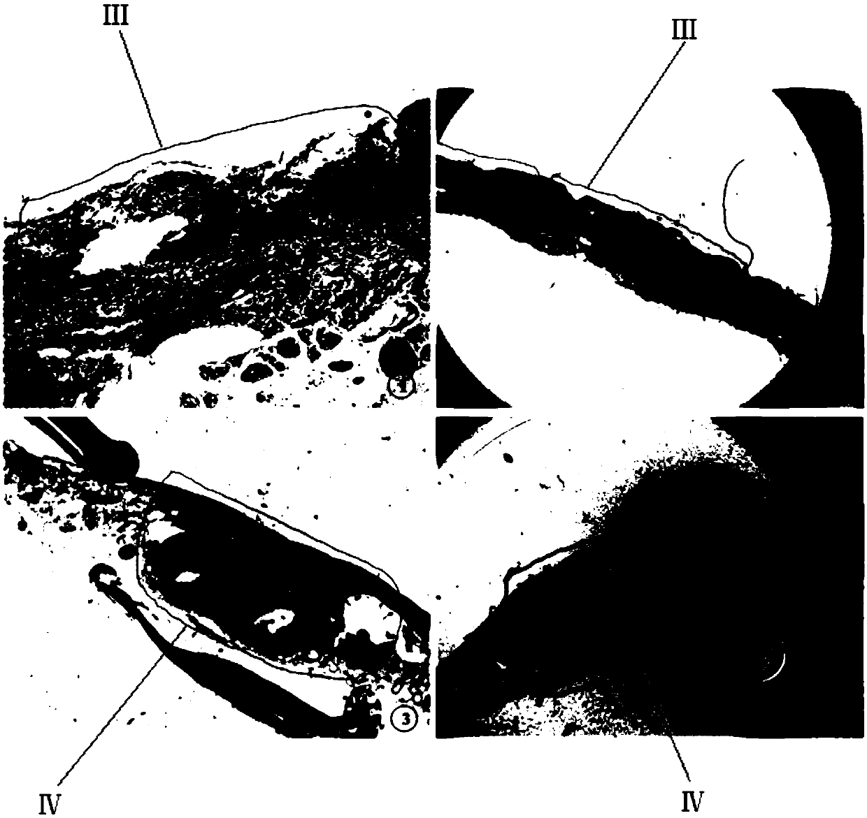 A screening method for marker proteins of lgien and hgien before esophageal squamous cell carcinoma