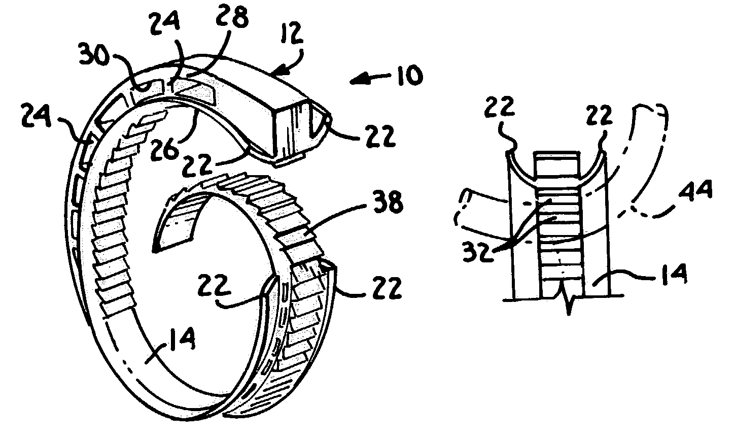 Cable retention device