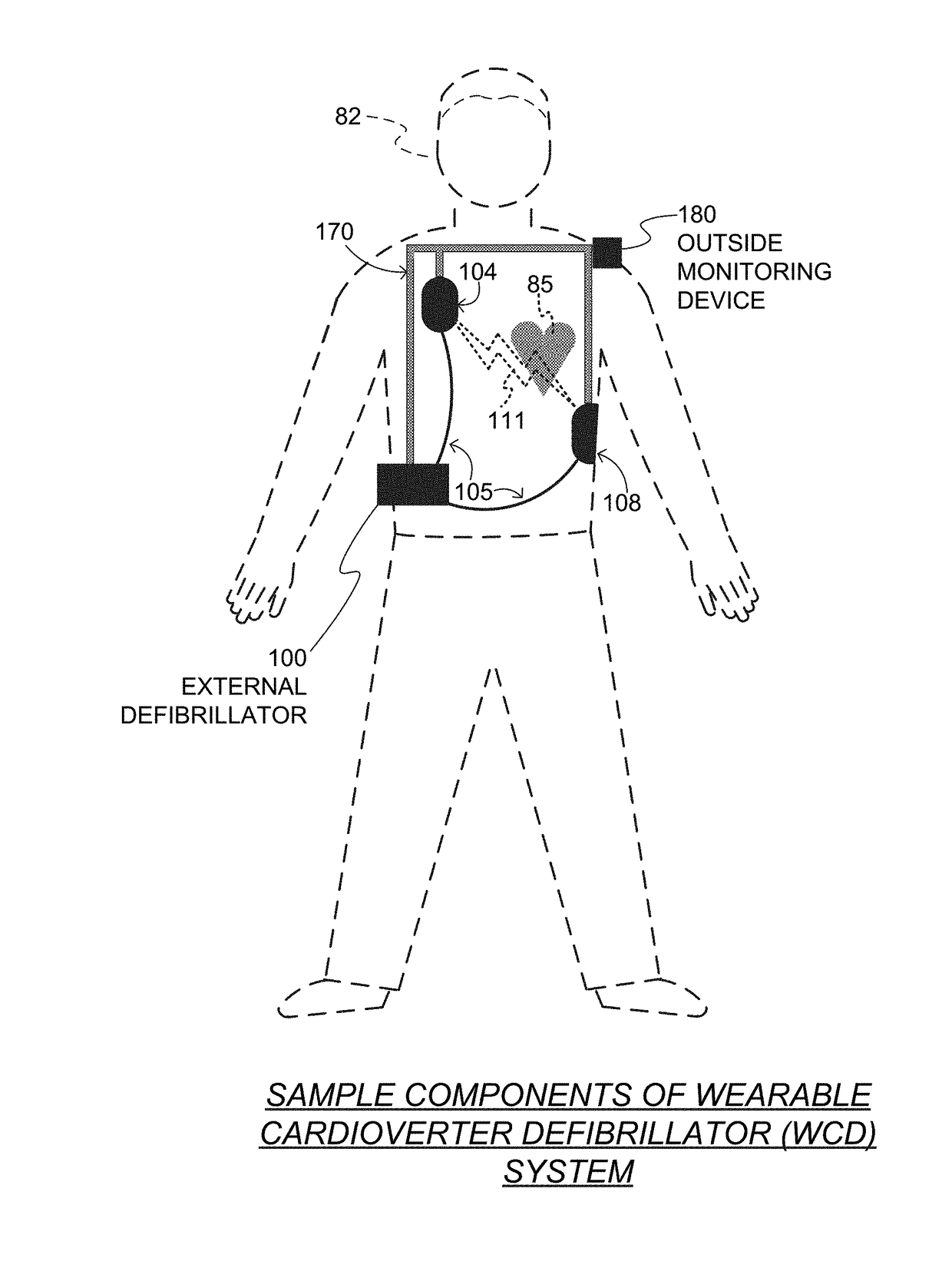 Wearable cardioverter defibrillator (WCD) system computing heart rate from noisy ECG signal