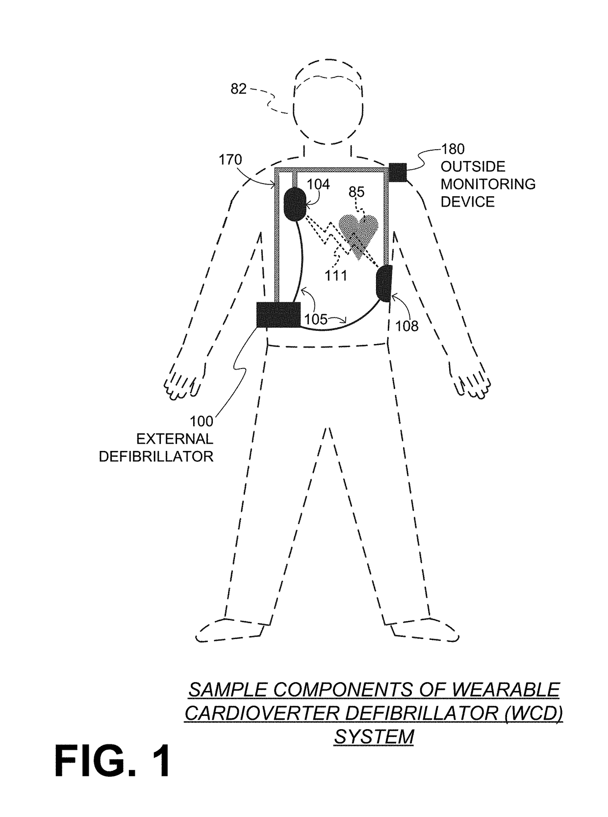 Wearable cardioverter defibrillator (WCD) system computing heart rate from noisy ECG signal