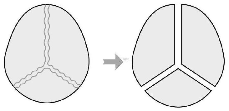 A Technical Method for Extracting Osteoclast Precursor Cells from Mouse Skull