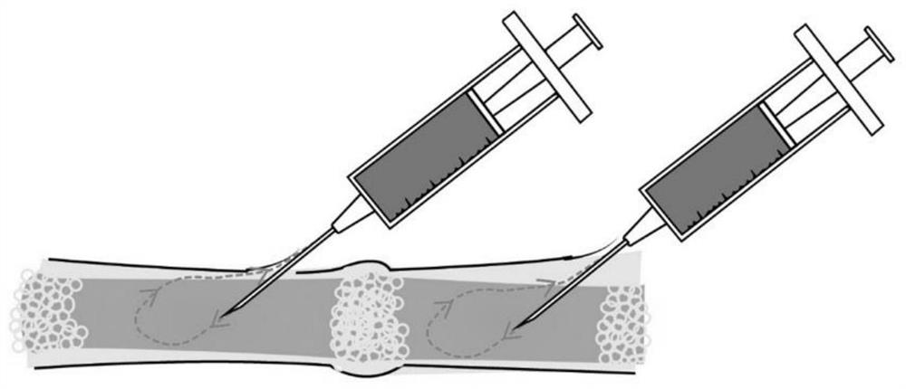 A Technical Method for Extracting Osteoclast Precursor Cells from Mouse Skull