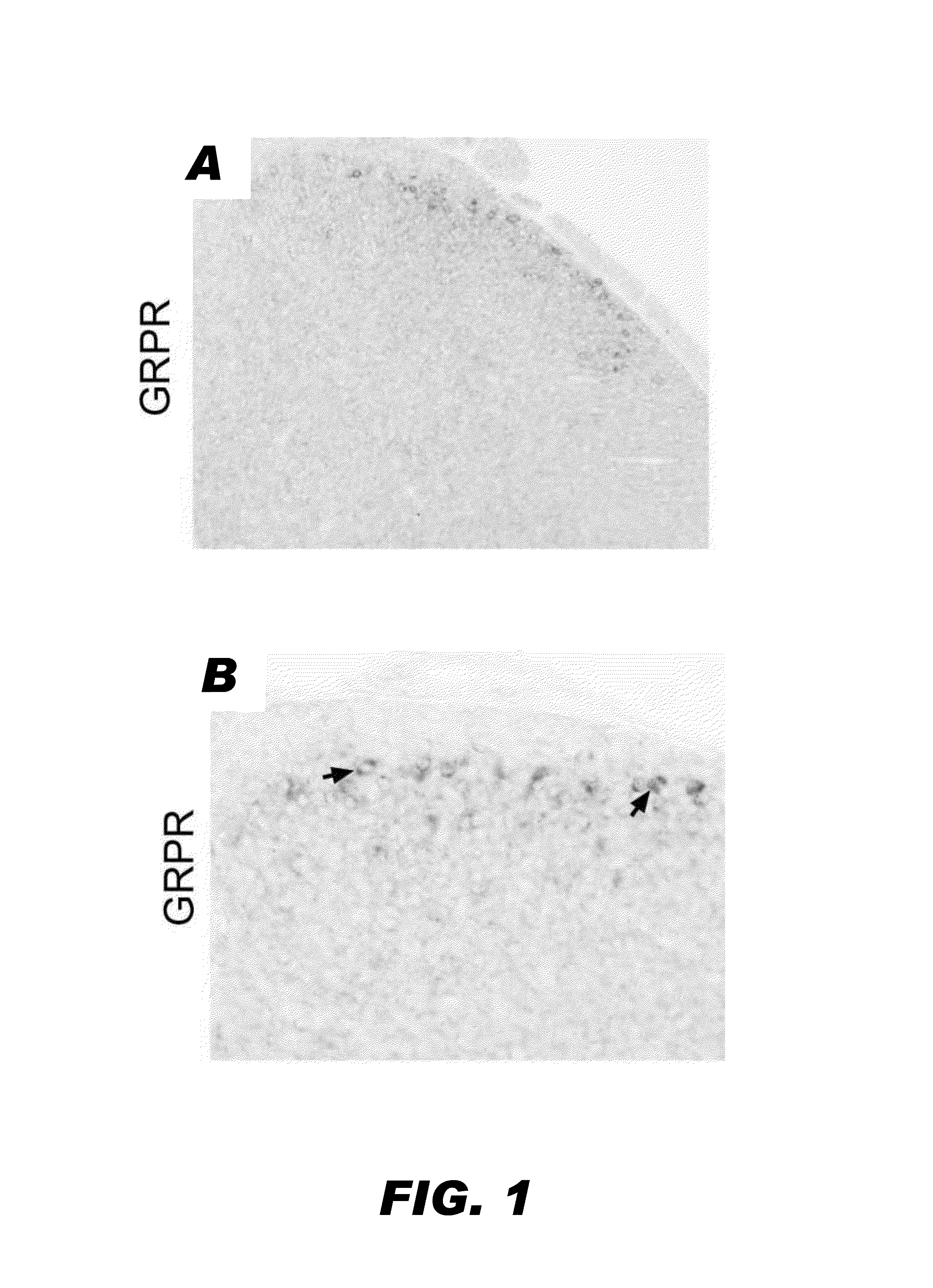 Compositions and methods for treating pruritus