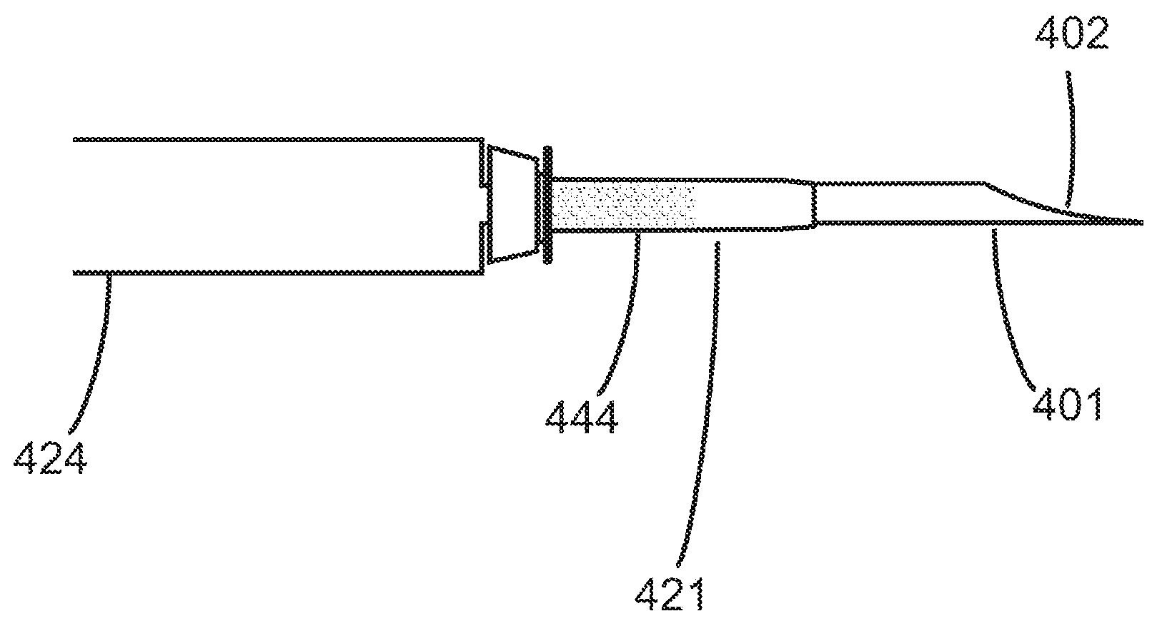System of instruments for vitrectomy surgery comprising sharp trochar, cannula and canula valve cap and method for its use
