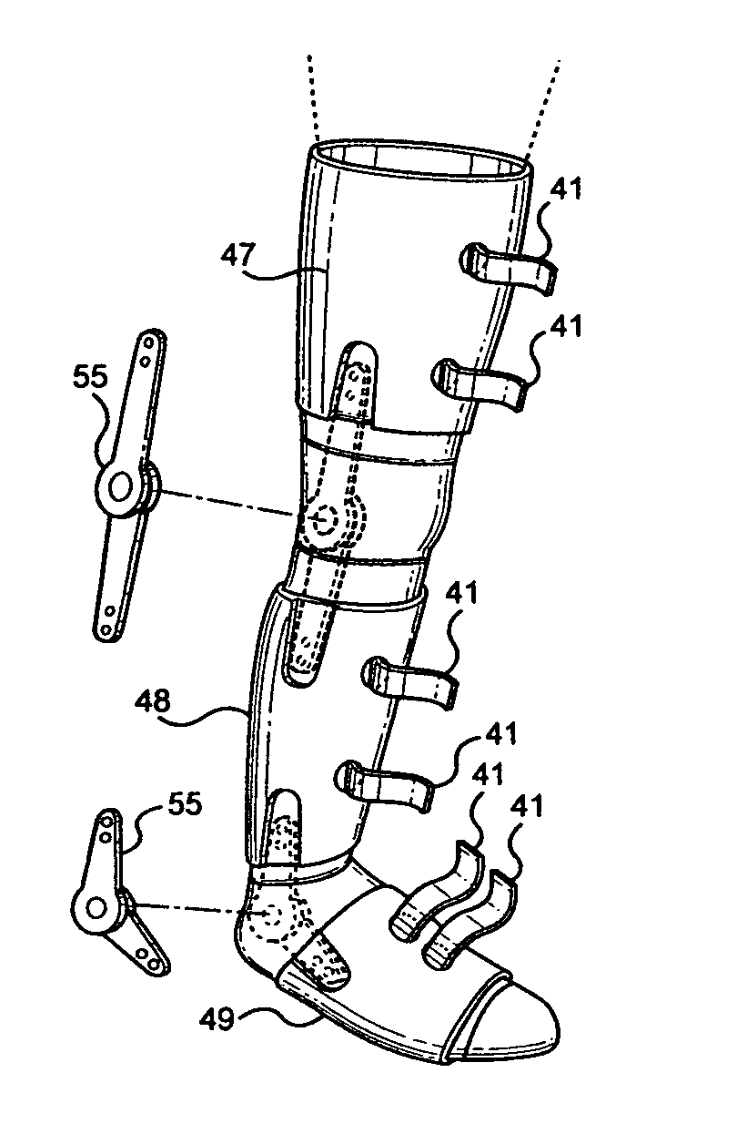 Braided orthotic products and methods of manufacture