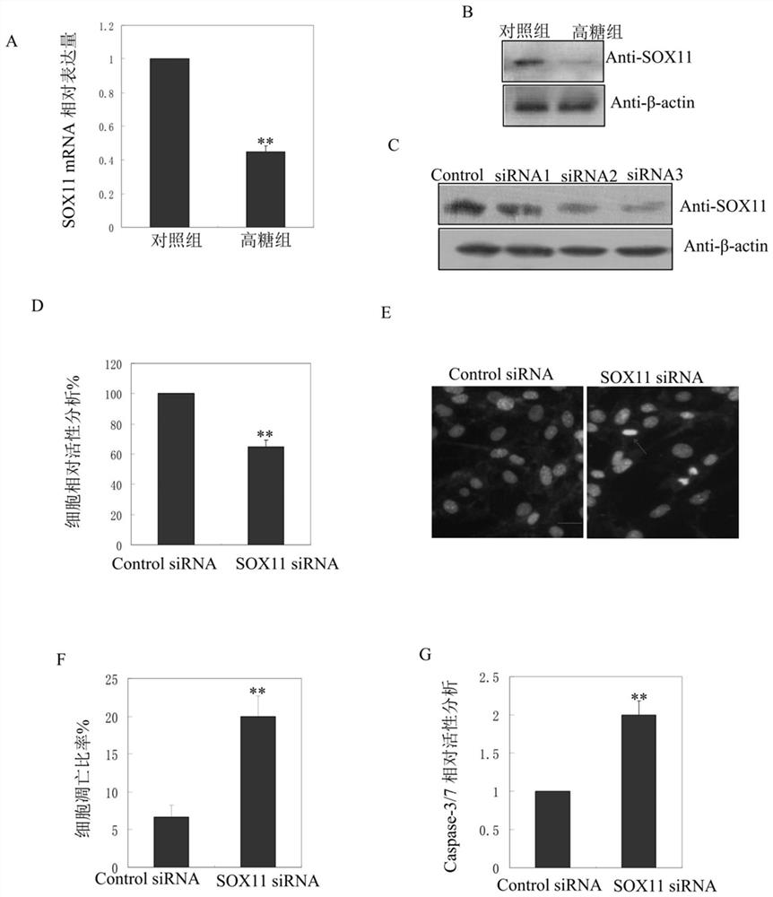 Application of SOX11 gene in detecting and/or regulating myocardial cell excessive apoptosis