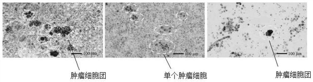 Malignant pleural effusion tumor cell separation device and method