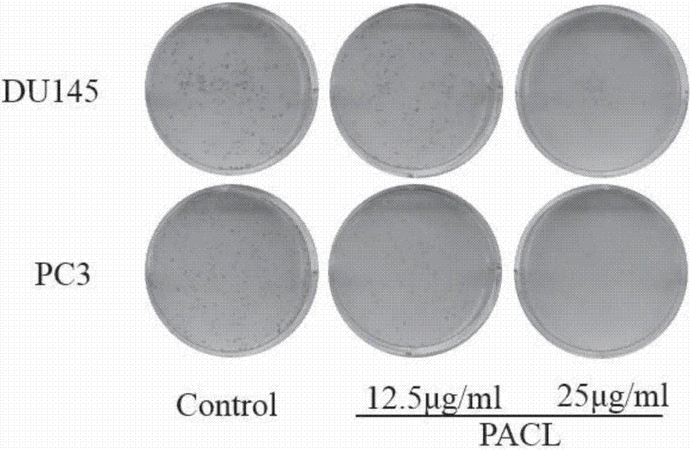 Aegiceras corniculatum leaf petroleum ether extract and its preparation method and use in treatment on prostatic cancer