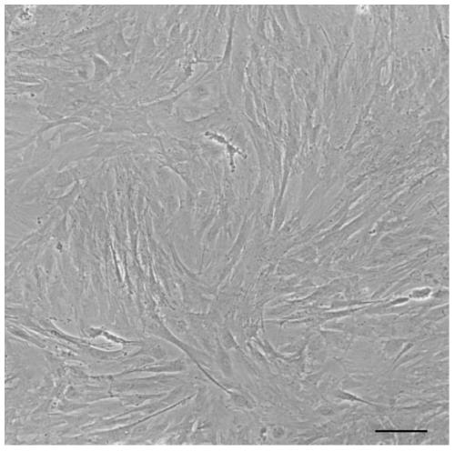 A kind of saddle grouper kidney tissue cell line and its construction method