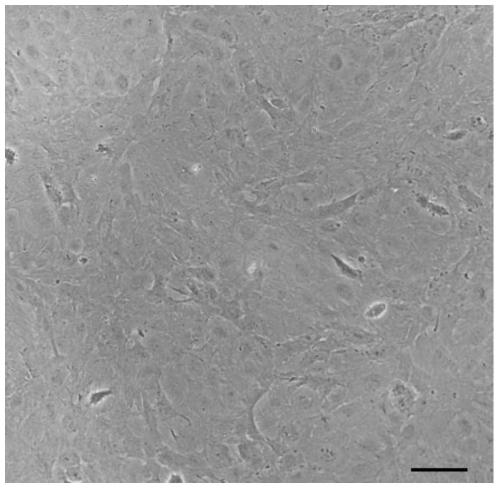 A kind of saddle grouper kidney tissue cell line and its construction method