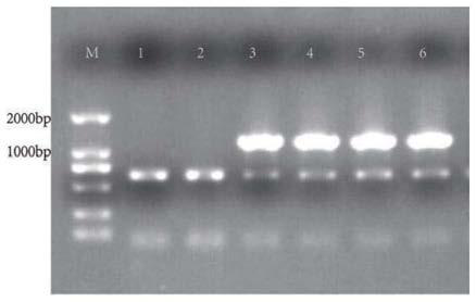 Candida utilis three-gene expression strain capable of degrading protein and building method of Candida utilis three-gene expression strain