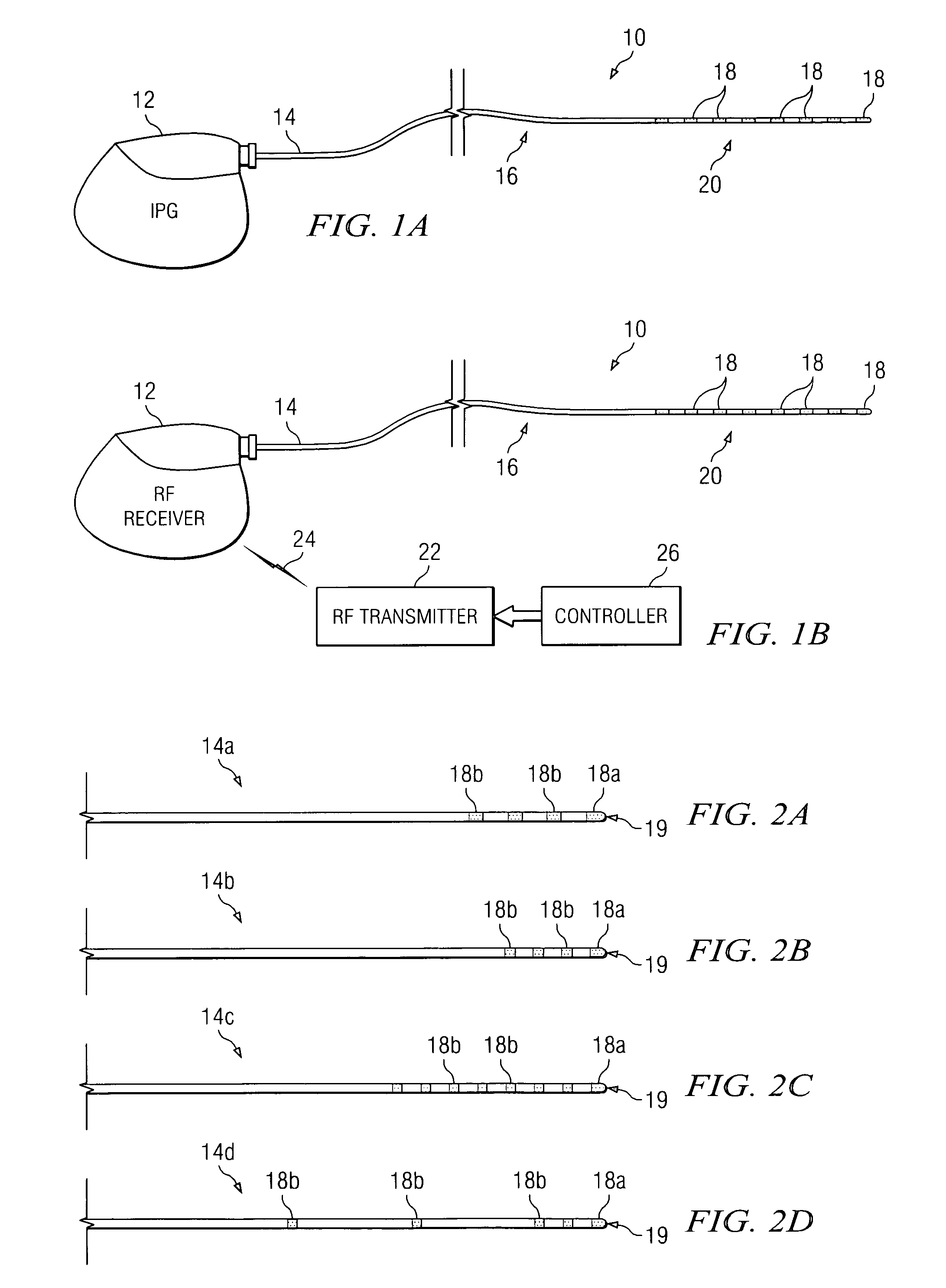 Electrical stimulation system and method for stimulating nerve tissue in the brain using a stimulation lead having a tip electrode, having at least five electrodes, or both