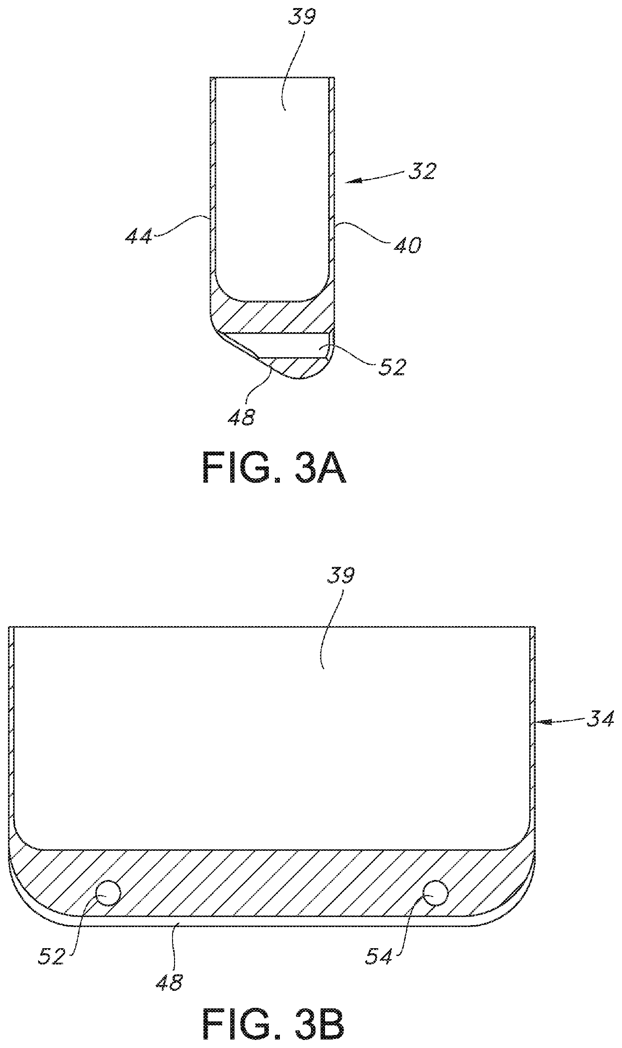 Implantable pulse generator with multiple suture ports
