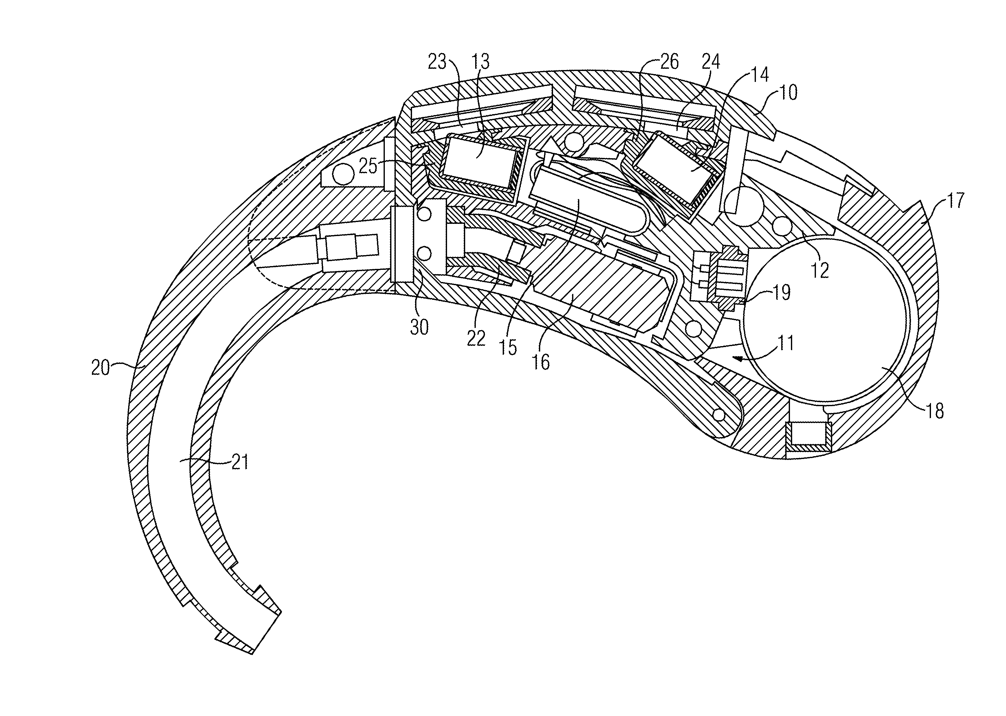 Method of installing a signal processing component in a housing of a hearing apparatus and hearing apparatus