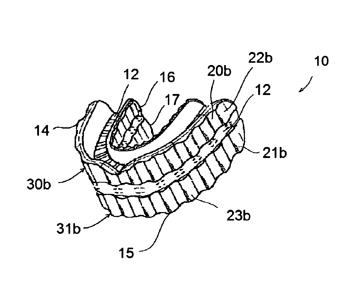 Aerobic mouthguard adapted to permit larger oral osmosis while diffusing larger oral shock
