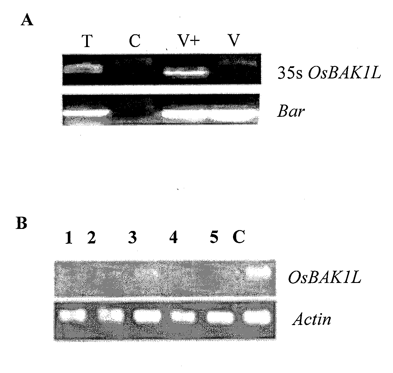 Receptor kinase albuminoid of rice brassinosteroid and coding genes and applications thereof