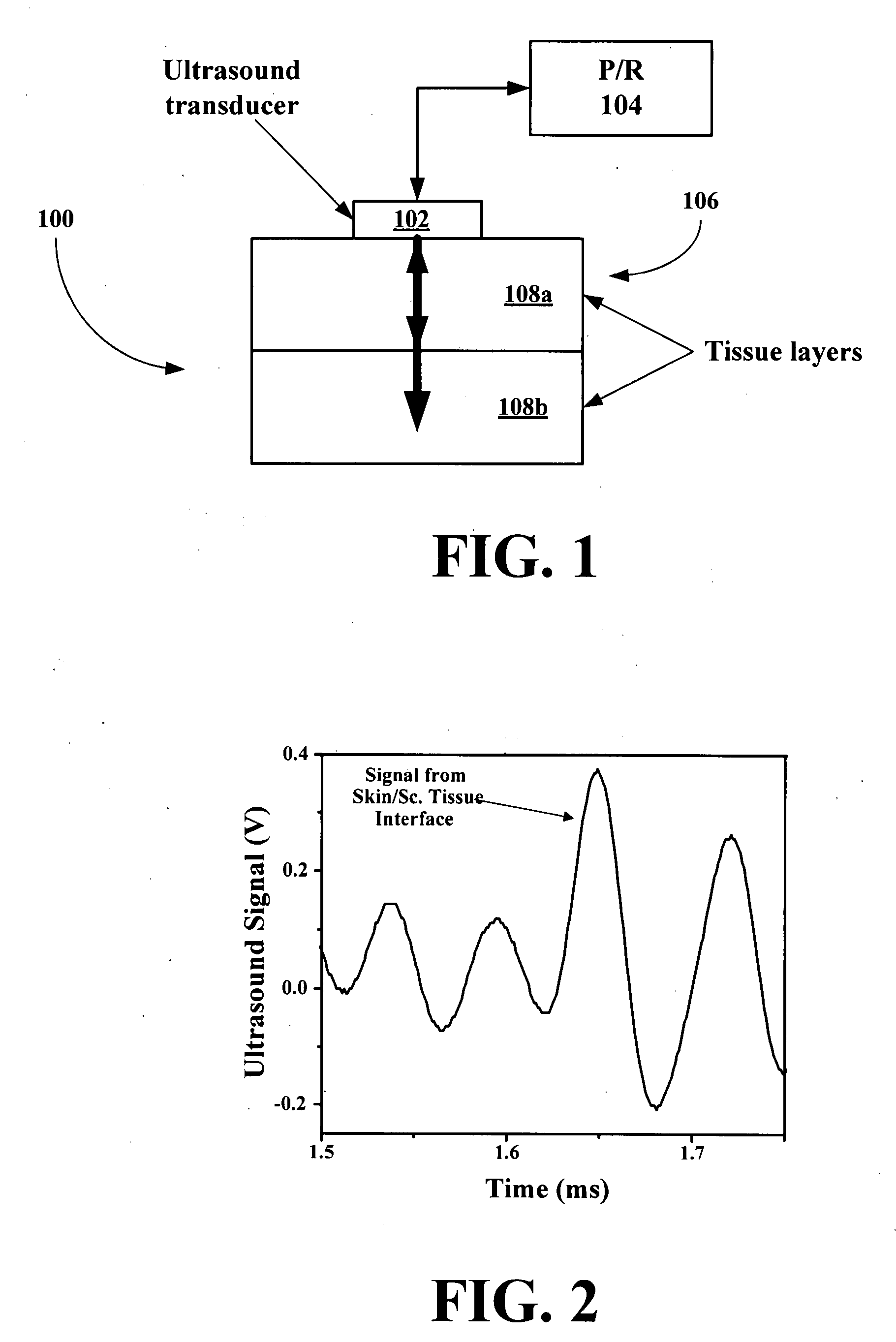 Noninvasive glucose sensing methods and systems