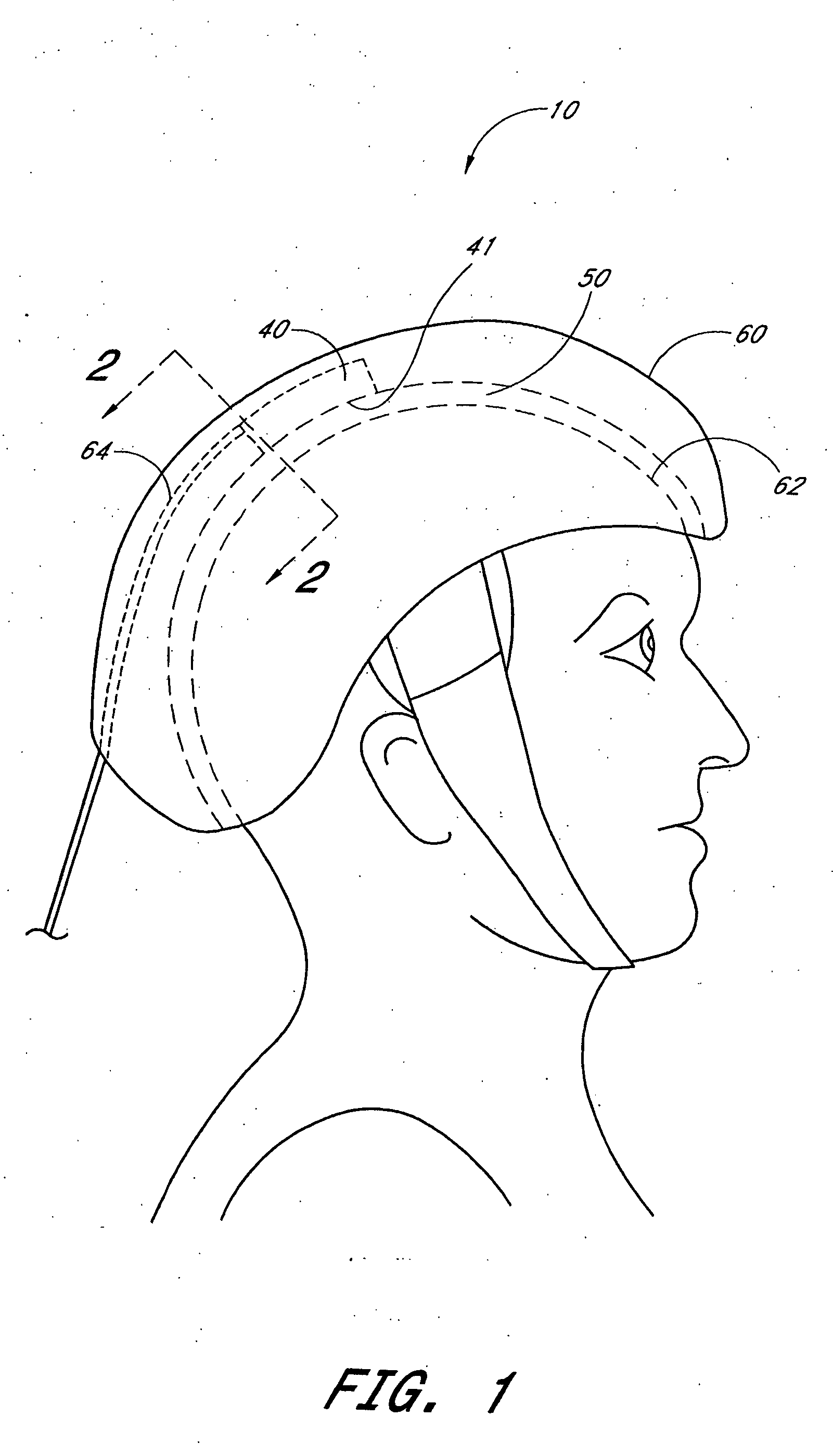 Device and method for providing phototherapy to the brain