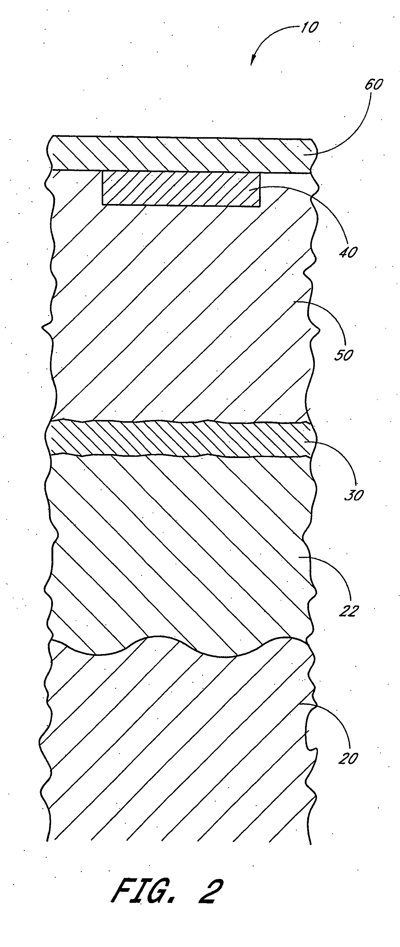 Device and method for providing phototherapy to the brain