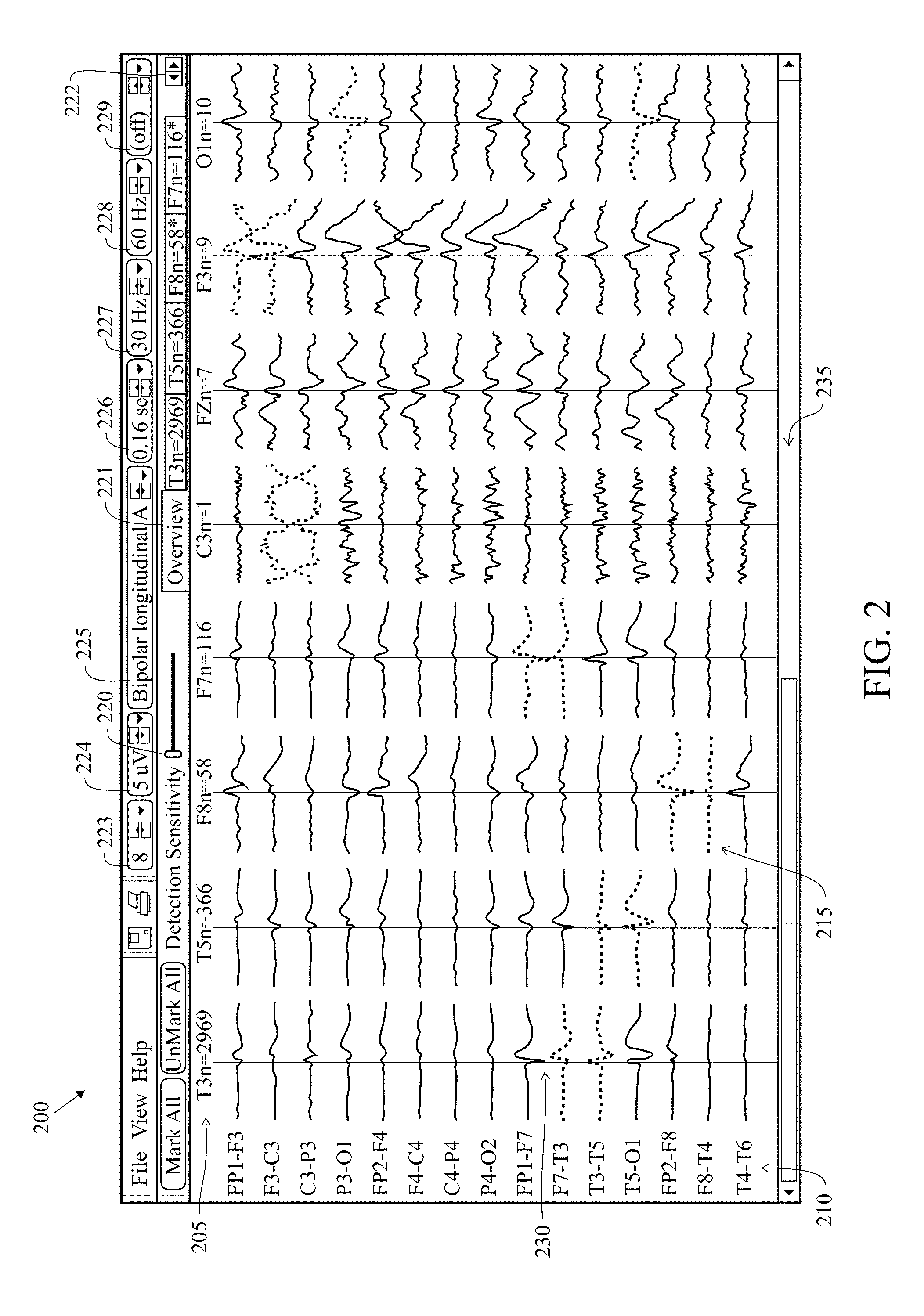 Method And System For Analyzing An EEG Recording