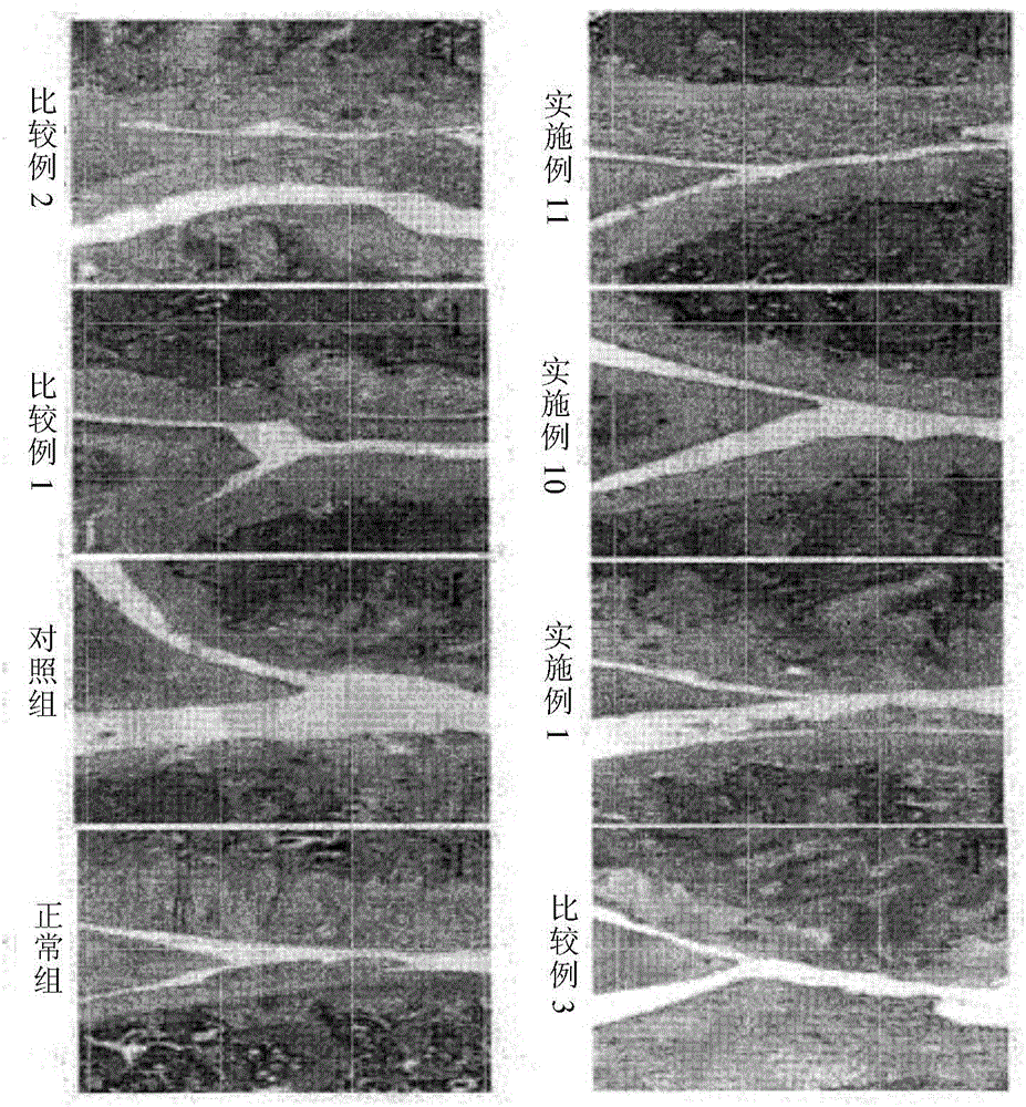 Pharmaceutical composition comprising extracts of symplococs chinesis and astragalus membranaceus for preventing and treating arthritis, and method for preparing same