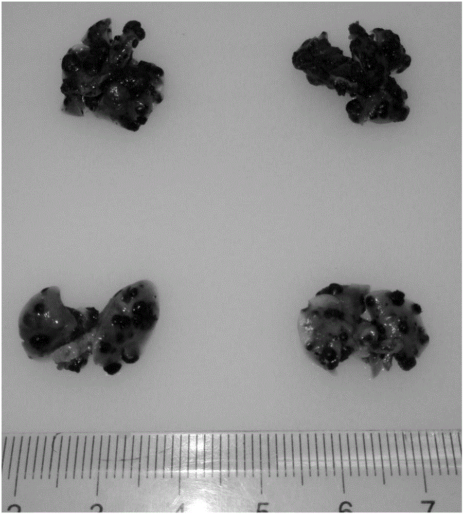 Applications of compound traditional Chinese medicinal composition in preparing medicines for inhibiting skin melanoma lung metastasis